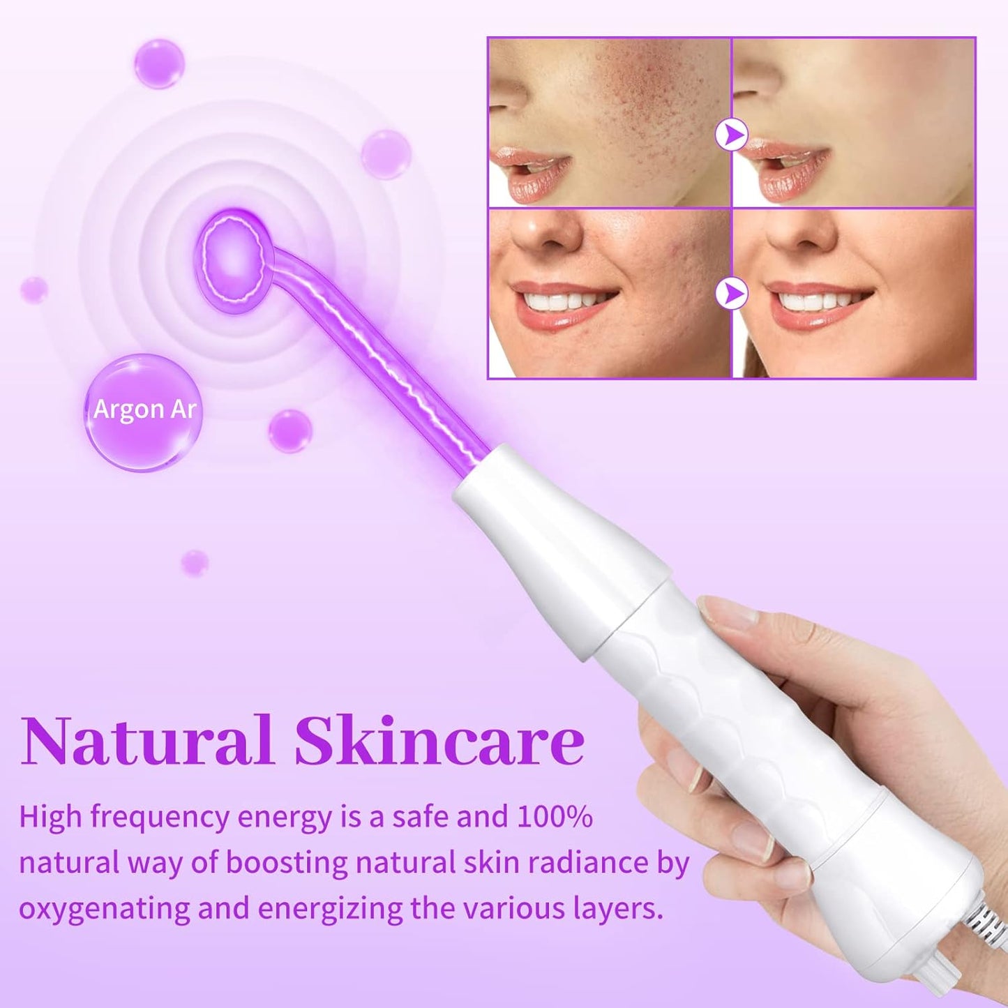 Portable High Frequency Facial Machine Wand Skin Tightening Facial, Firms Skin Reduces Wrinkles