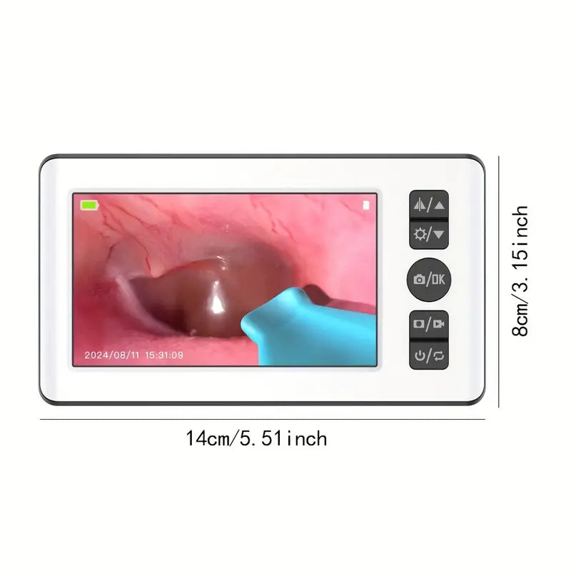 Medical-Grade Ear, Nose, Throat Endoscope with 4.3” HD Display & 3.5mm HD Portable Camera - with USB/Powersource Compatibility, Real-Time Visual Inspection for ENT Diagnosis, Ear Cleaning, Nasal/Sinus Procedures