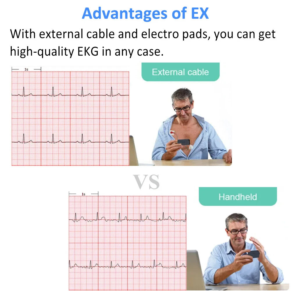 Wellue ECG Monitor, ECG Heart Rate Monitor, Bluetooth EKG Device with iOS and Android APP, Works with Smartphone and PC, 30s/60s/5mins Recording, Heart Health Tracker Home