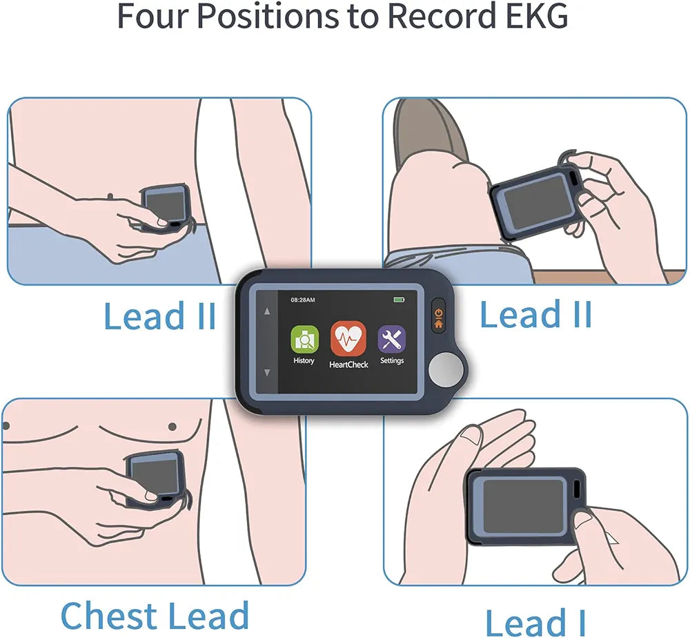 Wellue ECG Monitor, ECG Heart Rate Monitor, Bluetooth EKG Device with iOS and Android APP, Works with Smartphone and PC, 30s/60s/5mins Recording, Heart Health Tracker Home