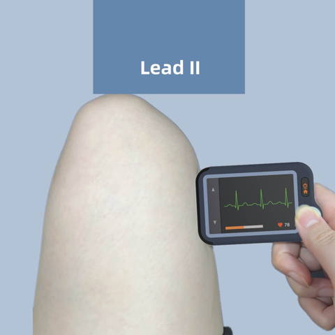 Wellue ECG Monitor, ECG Heart Rate Monitor, Bluetooth EKG Device with iOS and Android APP, Works with Smartphone and PC, 30s/60s/5mins Recording, Heart Health Tracker Home