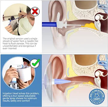 Electric Ear Wax Removal Irrigation Cleaner - Earwax Cleaning Kit Ear Wax Washer Lavage Earwax Flushing Tool Electric Otoclears Earigator System (Purple)