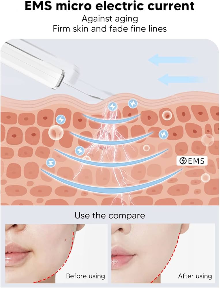 Spatula Face Skin Scrubber, Skin Scrubber, Blackhead Removal Facial Cleanser EMS Ultrasonic Peeling Machine Skin Care Tool