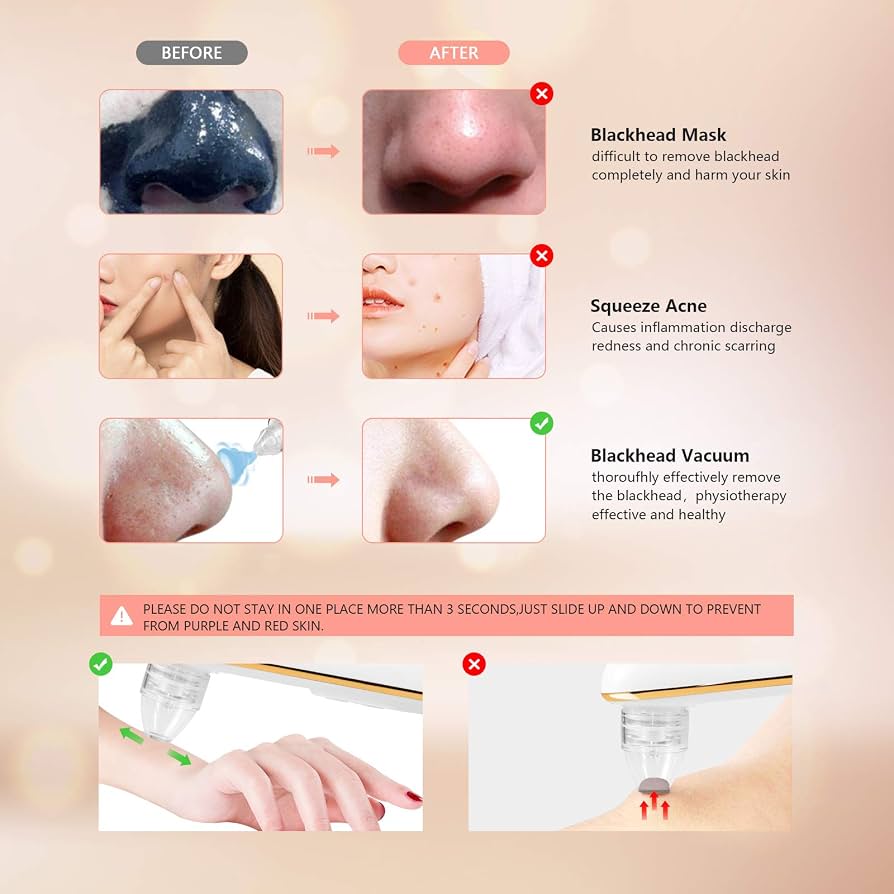 YODI Blackhead Remover Vacuum