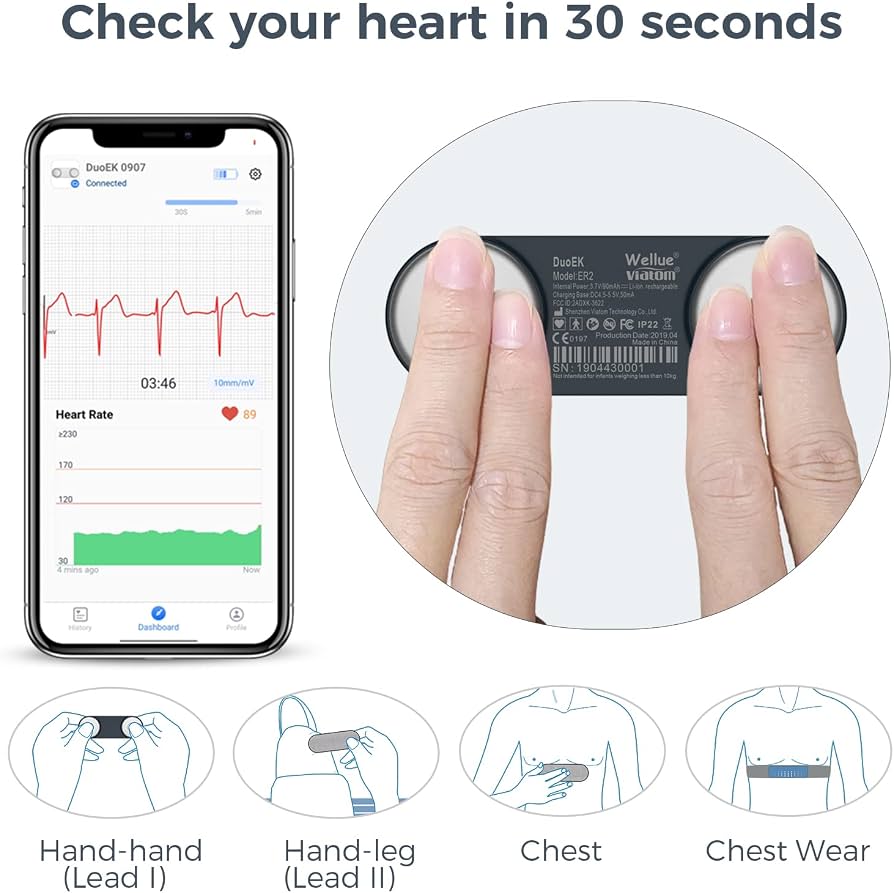 Wellue DuoEK ECG Heart Chest Bracelet Portable ECG Monitor