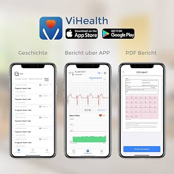 Wellue DuoEK ECG Heart Chest Bracelet Portable ECG Monitor