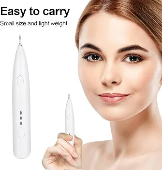 Mini Freckle Pen  Beauty Pen Moles Spots Tattoos Remover