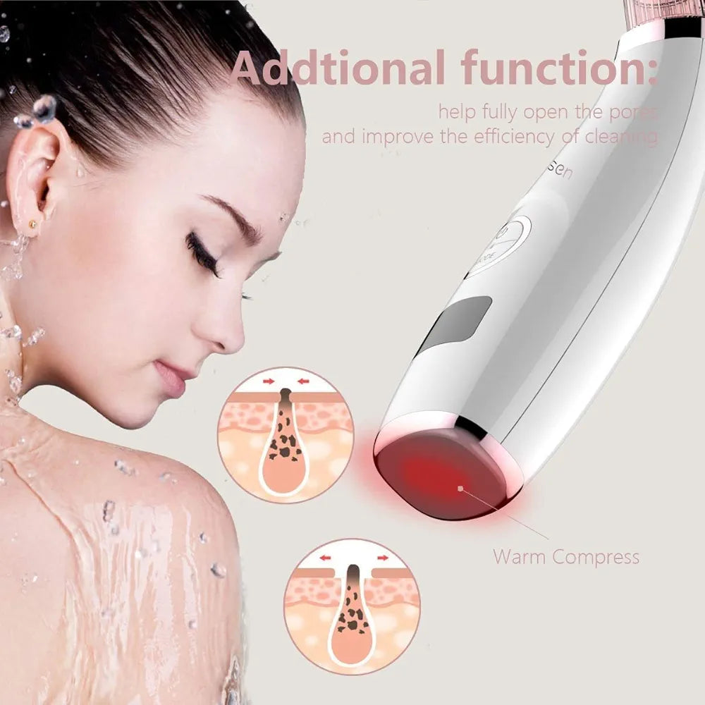 Mosen M1905 Blackhead Remover -Pink,5 Adjustable Level