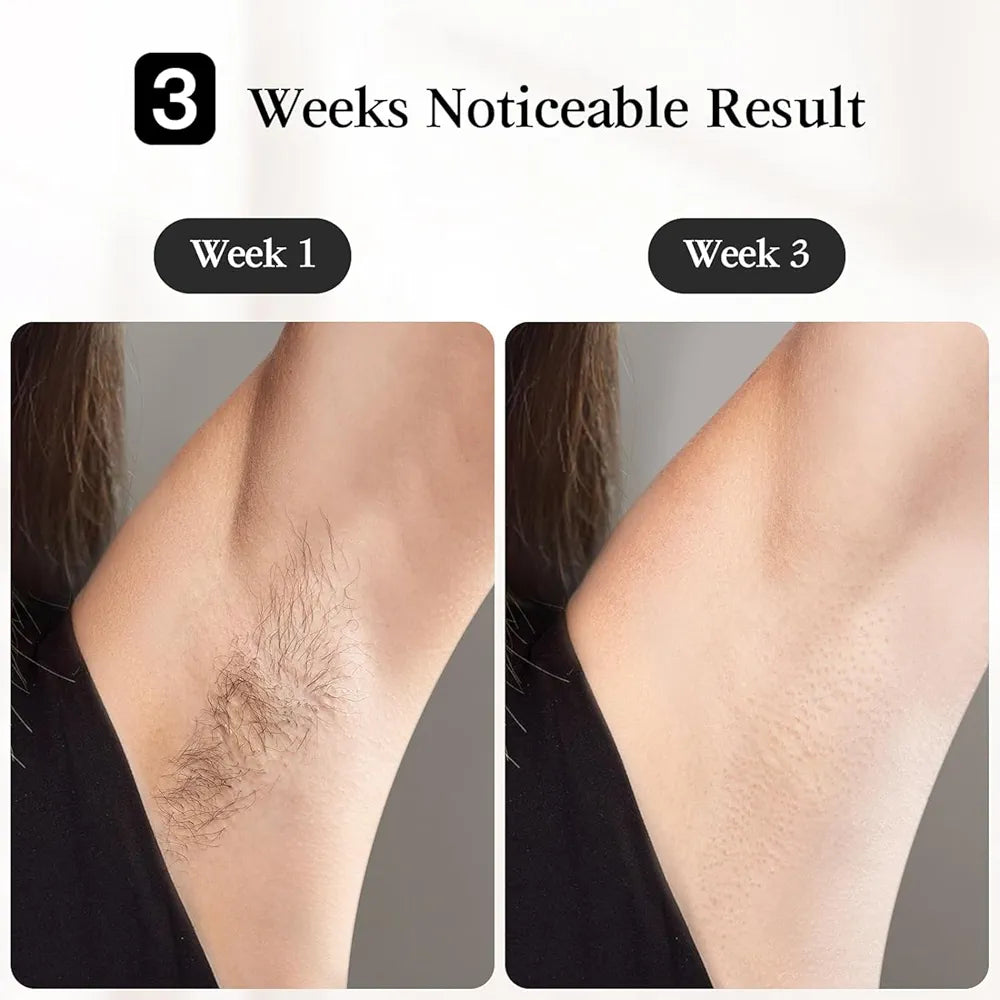 IPL Devices Hair Removal, JOVS Venus Pro, [Hair Removal and Skin Rejuvenation 2 in 1], IPL Hair Removal Device, 6 Filters - Face, Upper Lip, Chin, Bikini, Armpits, Legs & Full Body Insert