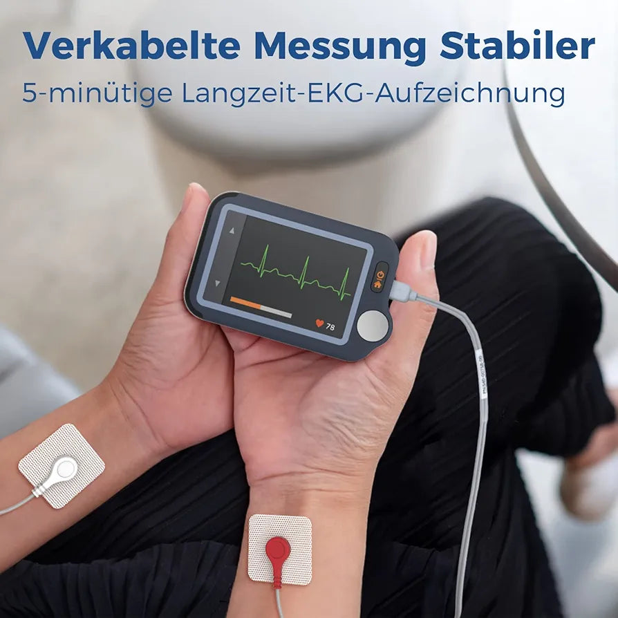 Wellue ECG Monitor, ECG Heart Rate Monitor, Bluetooth EKG Device with iOS and Android APP, Works with Smartphone and PC, 30s/60s/5mins Recording, Heart Health Tracker Home