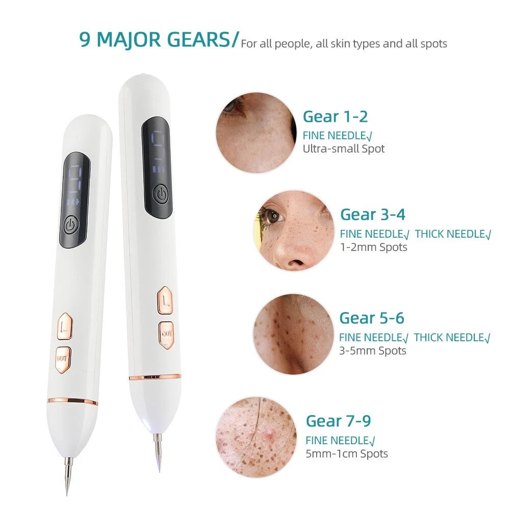 Laser Plasma Pen Mole Removal
