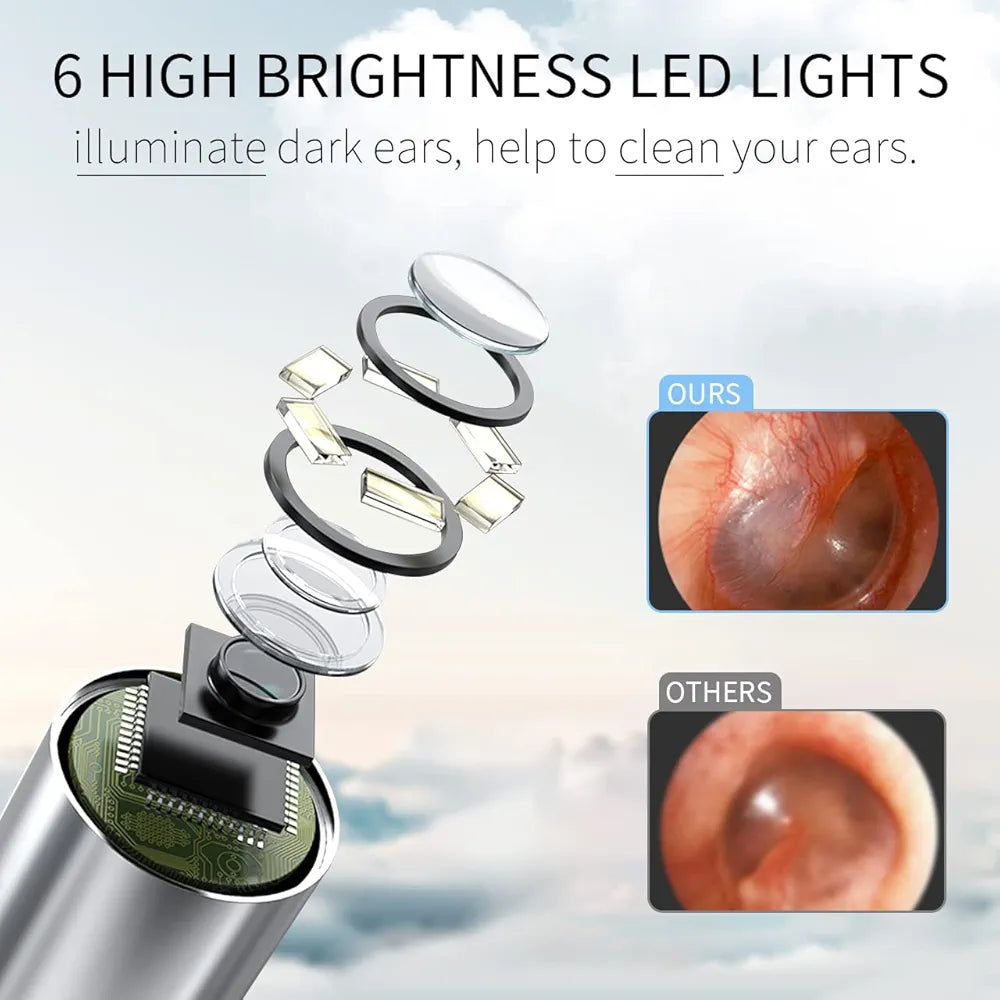 GPEESTRAC Ear Wax Removal Ear Camera Wireless Ear Otoscope with 6 LED Light Earwax Cleaner Compatible with iPhone iPad Android Earwax Removal Kit for Kids, Adults,Pets