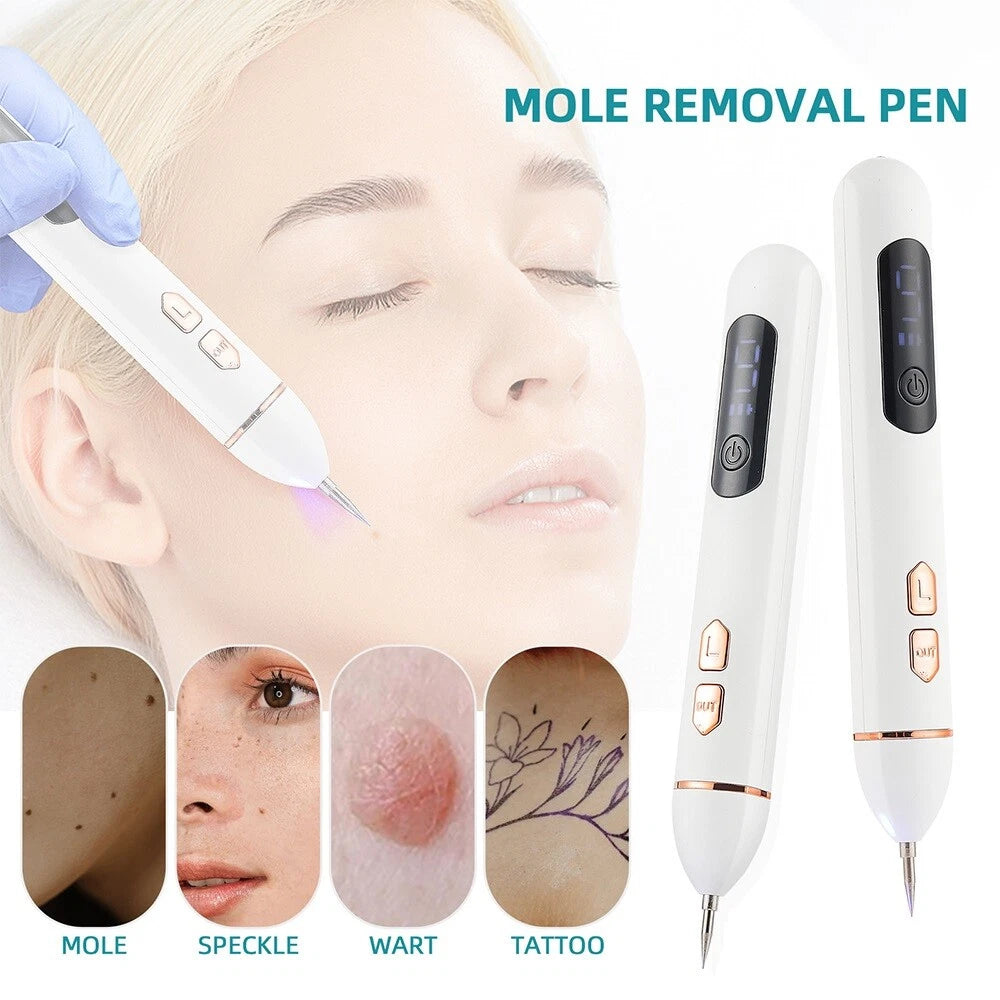 Laser Plasma Pen Mole Removal