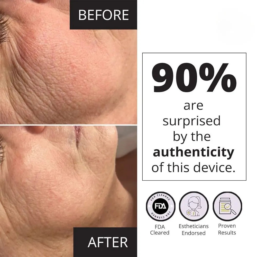 Wellness 7E MyoLift Mini Microcurrent Facial Device - Non-Invasive Face Lift, Facial Skin Care Products for Anti Aging, Skin Tightening - Esthetician Supplies and Skin Care Tools - Up to 400 Microamps